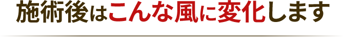 施術後はこんな風に変化します